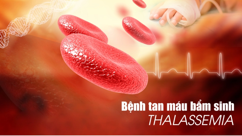 Hình ảnh bệnh tan máu bẩm sinh là như thế nào