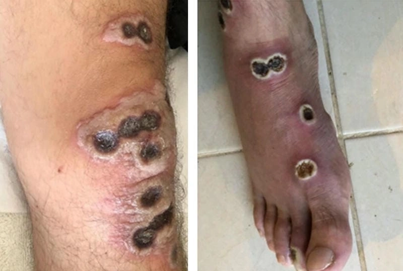 Bộ sưu tập hình ảnh về hiv aids sinh động