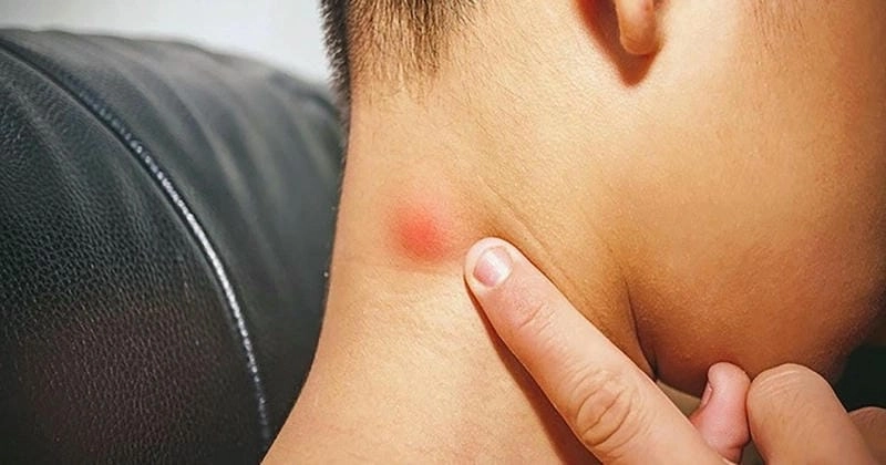 Hình dung rõ bệnh hiv/aids là gì qua ảnh