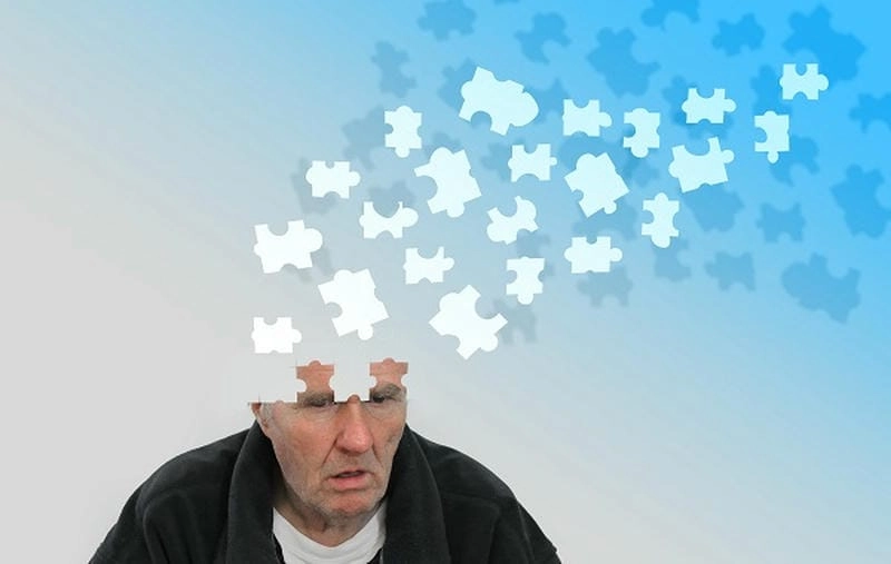 Giải đáp câu hỏi alzheimer có chữa được không qua hình ảnh