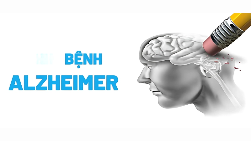 Hình ảnh bệnh alzheimer là như thế nào