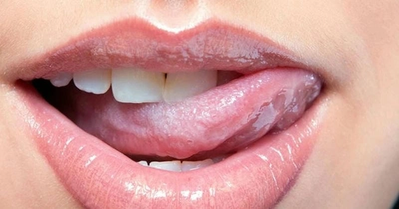 Dấu hiệu rõ ràng ở người bị bệnh bạch sản lưỡi