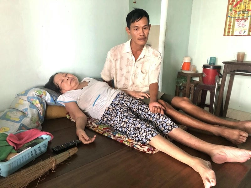 Tổng hợp ảnh người bị bệnh bại liệt đa dạng góc nhìn