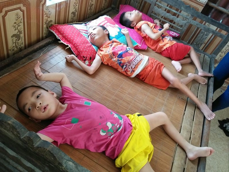 Chi tiết hình ảnh trẻ bị bại liệt nặng khó hồi phục