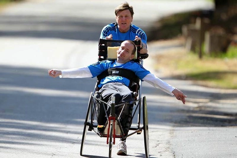 Khám phá hình ảnh biến chứng bại liệt trên cơ thể