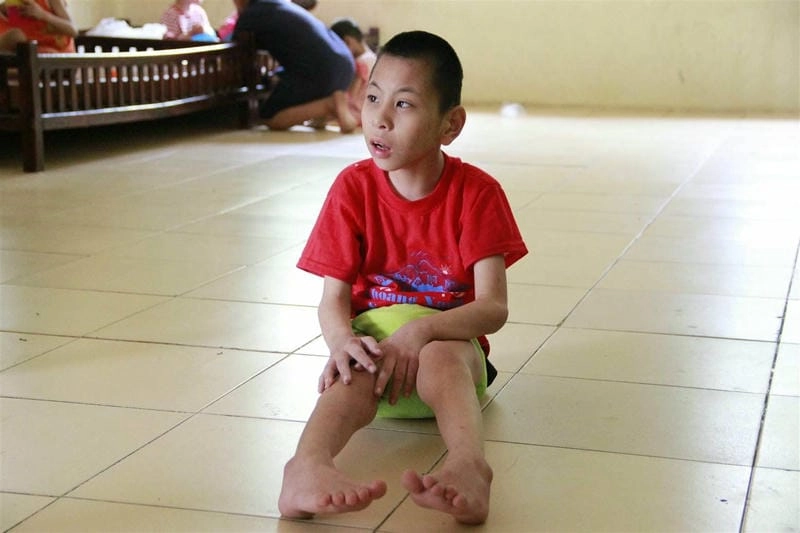 Hình ảnh minh họa người bị bại liệt thực tế