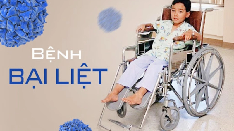 Hình ảnh bệnh bại liệt là như thế nào