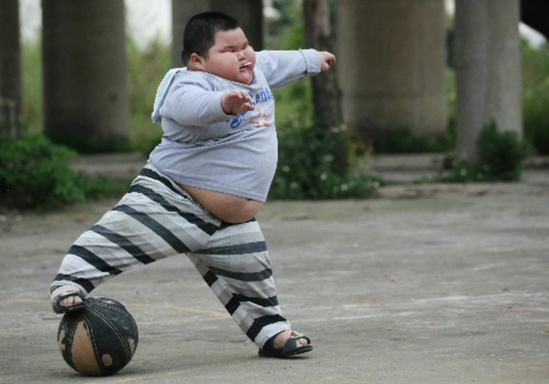 Chia sẻ những câu chuyện về người bị béo phì