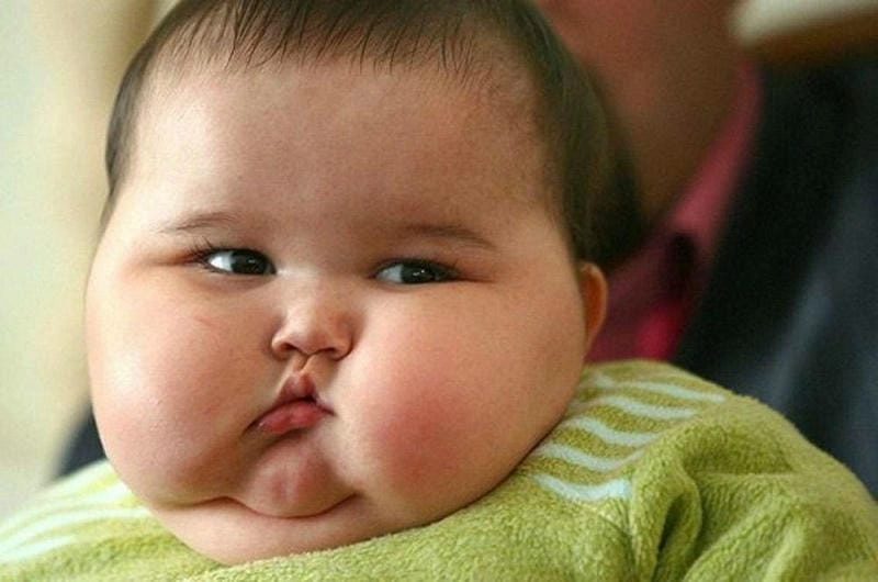 Tổng hợp các hình ảnh trẻ béo phì phổ biến hiện nay