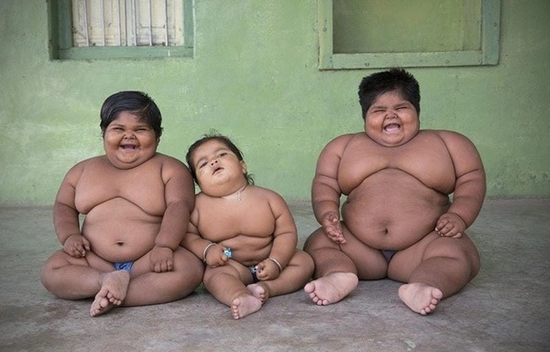 Nhận biết bệnh béo phì ở trẻ qua dấu hiệu đơn giản