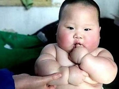 Xem ngay hình ảnh béo phì ở trẻ em chi tiết