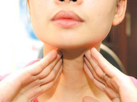 Xem ngay cách nhận biết bướu cổ bằng hình ảnh trực quan