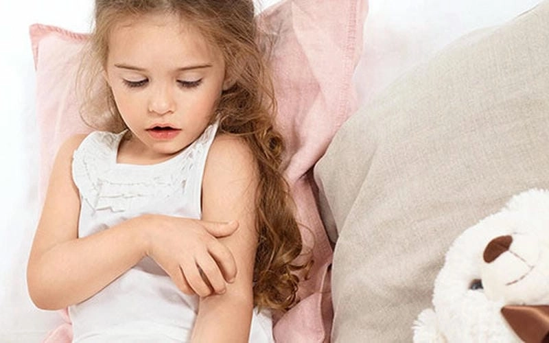 Xem kỹ hình ảnh trẻ bị bệnh chàm ở nhiều giai đoạn