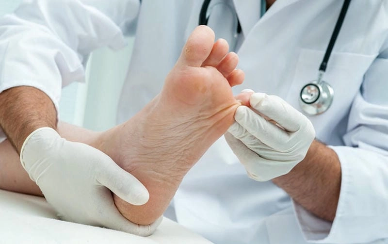 Phác đồ điều trị hiệu quả khi chữa bệnh chàm tổ đỉa