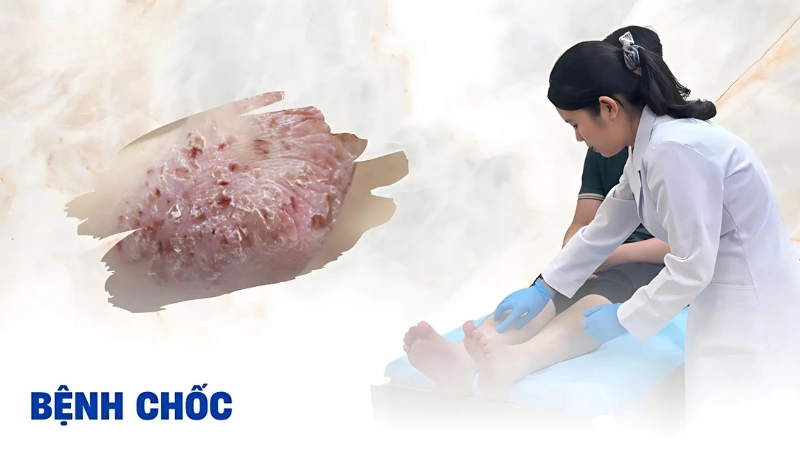 Hình ảnh bệnh tim là như thế nào