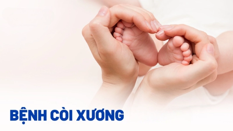 Hình ảnh bệnh còi xương là như thế nào