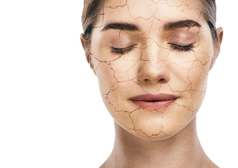 Tổng hợp cách chữa bệnh da rắn dân gian hữu ích