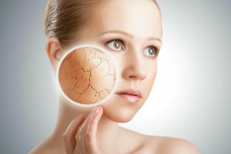 Mẹo dân gian hỗ trợ cách chữa trị da rắn an toàn