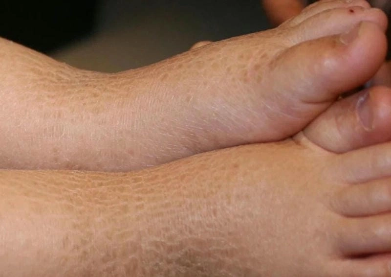 Thông tin y khoa và bệnh da rắn thường gặp