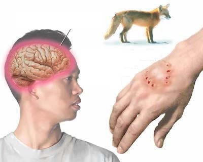 Xem ngay các ảnh bệnh dại ở chó nguy hiểm