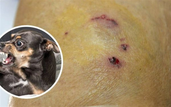 Bộ sưu tập ảnh bệnh dại cập nhật liên tục