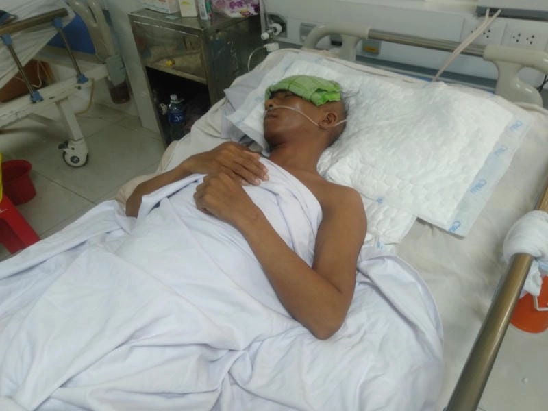 Tổng hợp rõ nét hình ảnh bệnh dại mới nhất