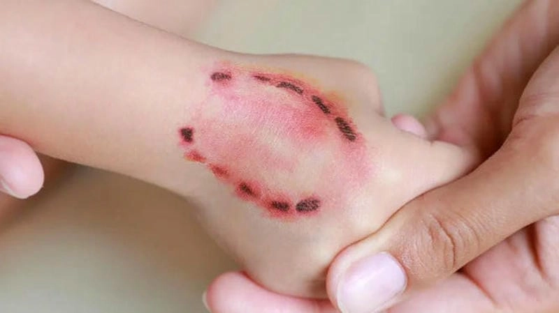 Cập nhật thông tin bệnh dại từ ảnh thực tế