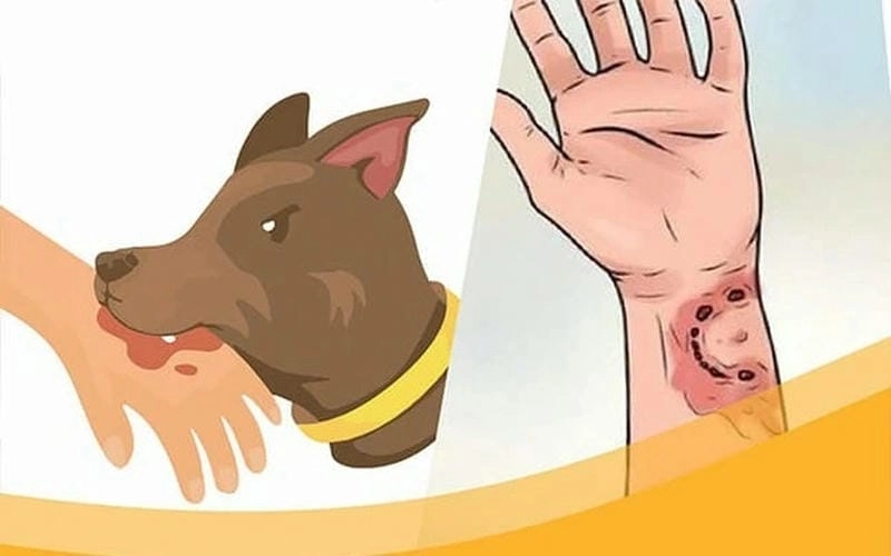 Tổng hợp hình ảnh người bị dại rõ ràng