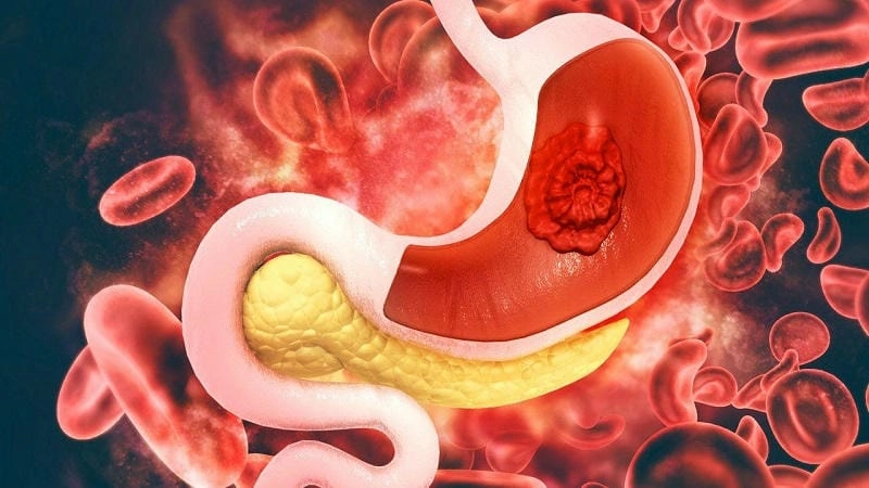 Quan sát kỹ ảnh trẻ bị đau dạ dày