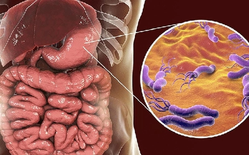 Mẹ nên lưu ý dấu hiệu trẻ bị đau dạ dày