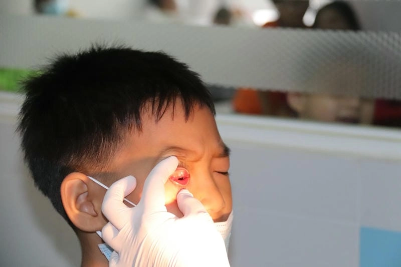 Tìm cách chữa bị đau mắt đỏ và sưng tại nhà hiệu quả