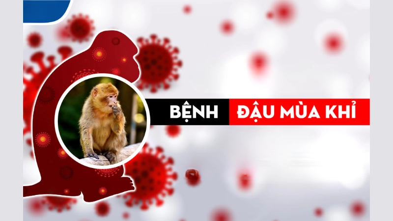 Hình ảnh bệnh đậu mùa khỉ là như thế nào