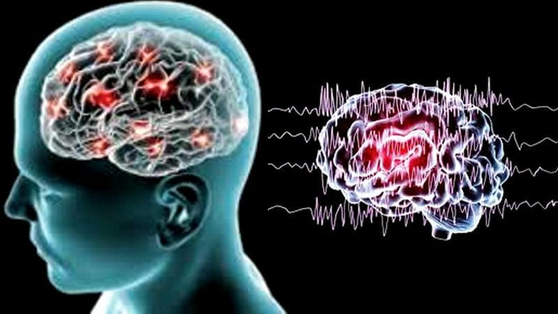 Hiểu đúng về bệnh động kinh qua hình ảnh thực tế