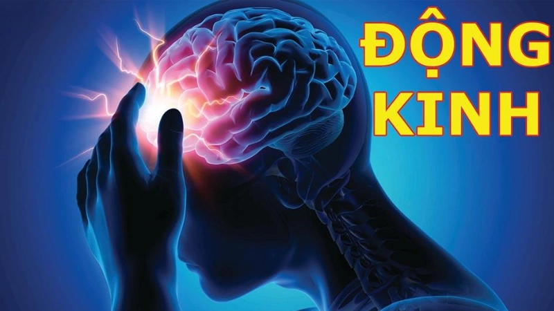 Hình ảnh bệnh động kinh là như thế nào 