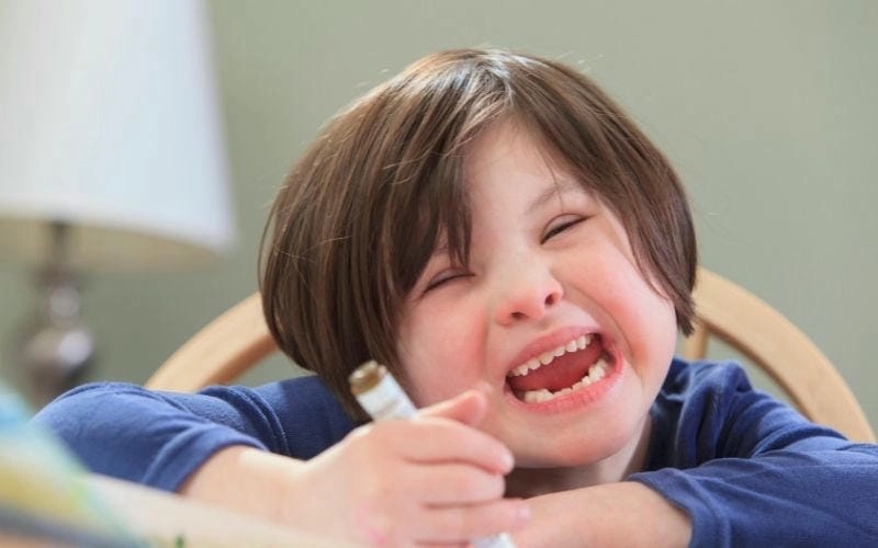 Lý giải khoa học bệnh down nguyên nhân