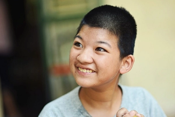 Làm gì khi con bị bệnh down từ nhỏ