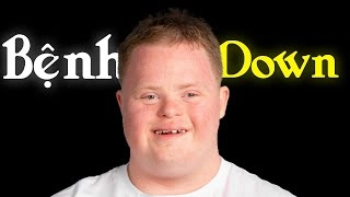 Thông tin chi tiết về bệnh đao di truyền