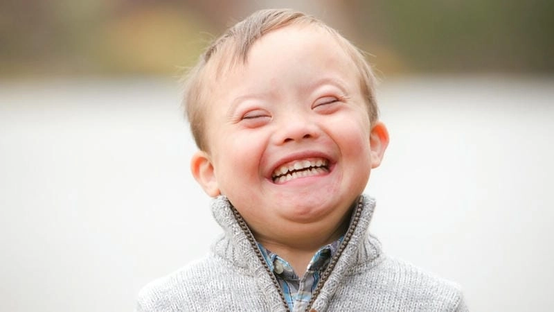 Câu chuyện cảm động về bệnh nhân bị down