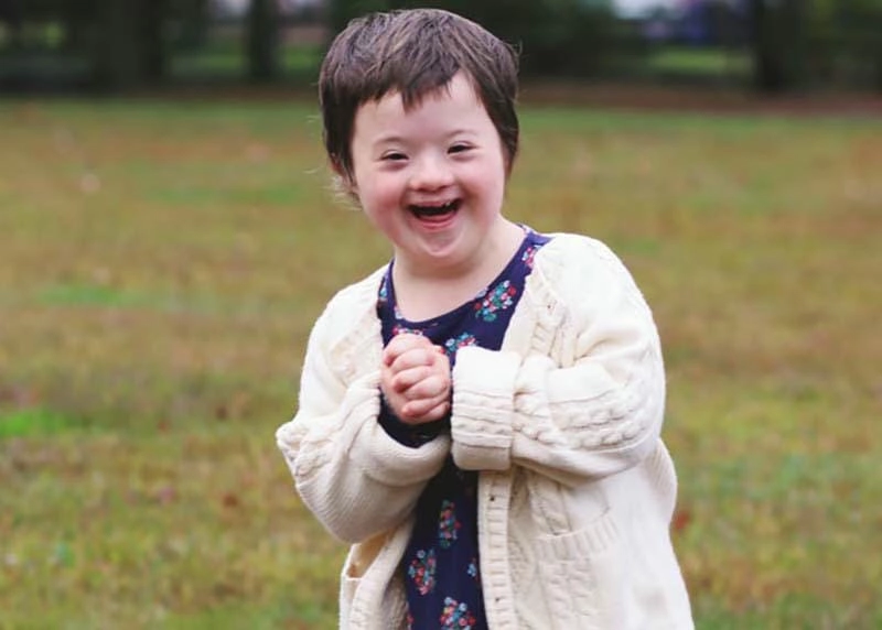 Tổng hợp hình ảnh người bị down rõ nét