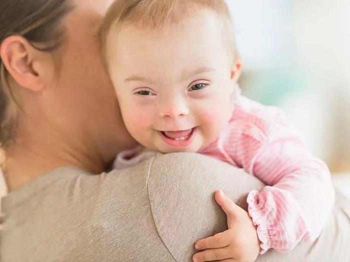 Cuộc sống thường ngày người mắc bệnh down