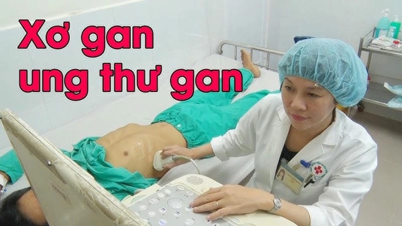 Chi tiết hình ảnh người lớn bị bệnh gan từng giai đoạn