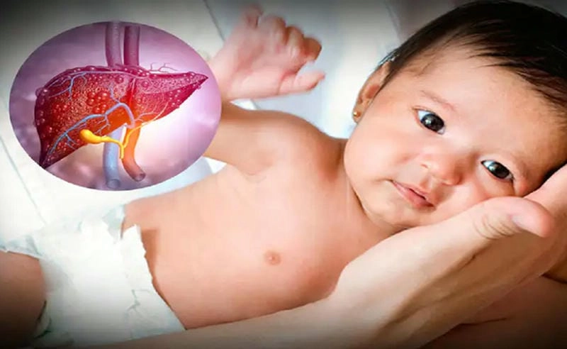 Cảnh báo u gan qua hình ảnh y học chân thực