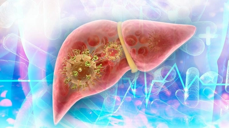 Xem rõ hình ảnh người bị xơ gan trên ảnh thật