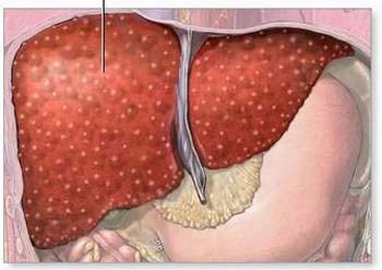 Khám phá ảnh mô gan bị xơ qua kính hiển vi