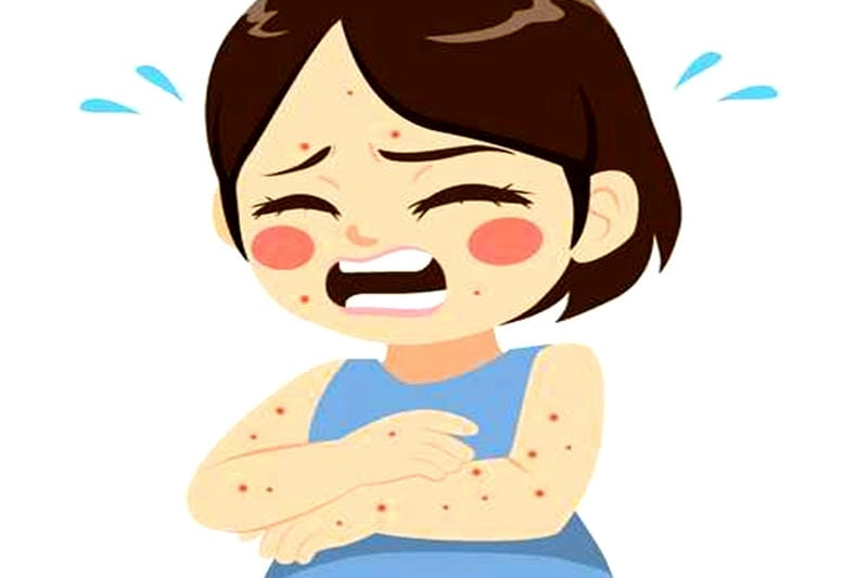 Phân biệt nhanh qua hình ảnh bị ghẻ ngứa chuẩn