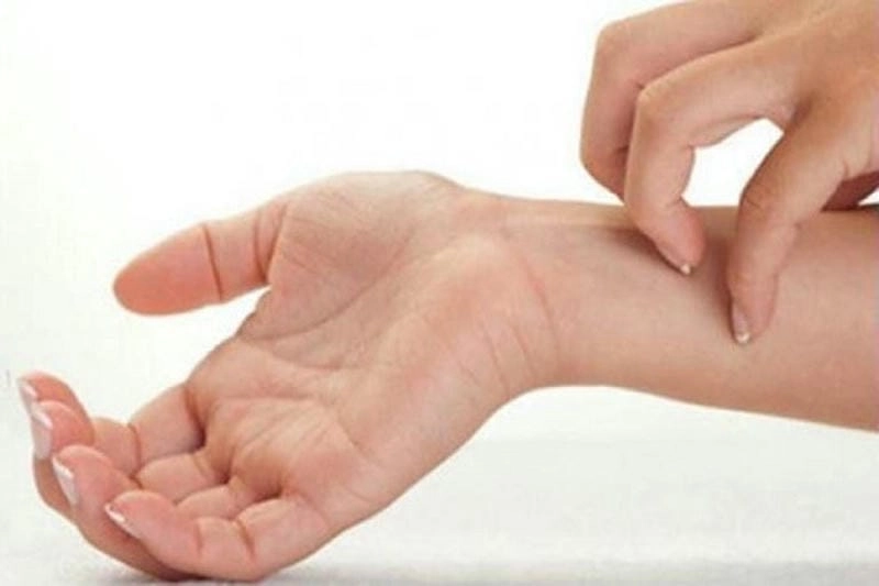 Tổng hợp hình ảnh bị ghẻ ruồi để dễ nhận biết