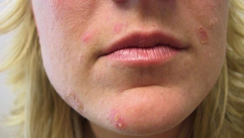 Hình dáng con giời leo thường gặp ở môi trường ẩm