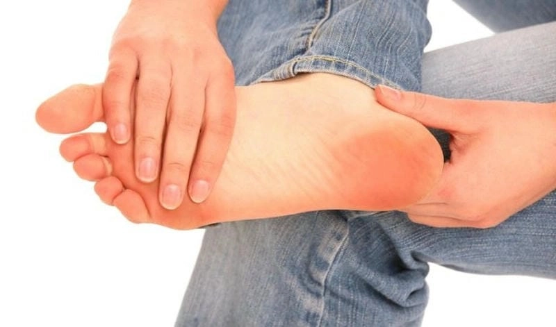 Hình ảnh bị gout cho thấy sự biến dạng ngón chân