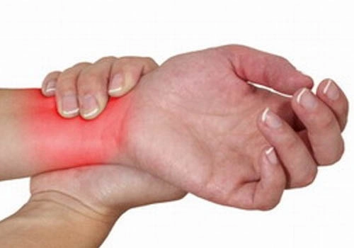 Xem ngay bộ sưu tập hình ảnh gout thực tế