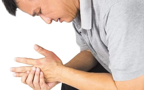 Tổng hợp hình ảnh chân bị gout chi tiết